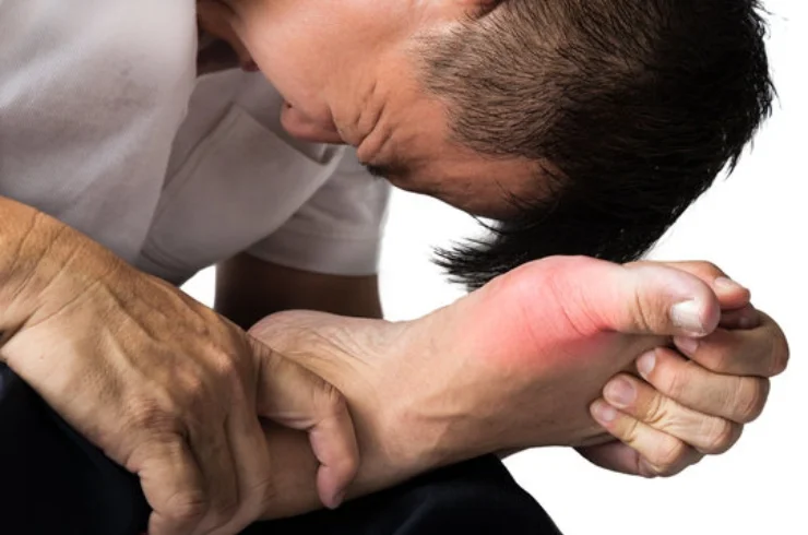 Gout-----13