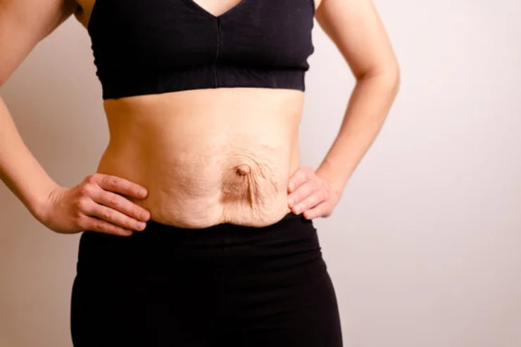 Hernia------13