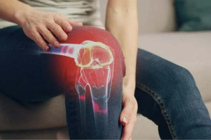Knee Pain--------13